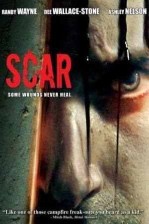 Scar