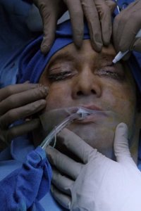 Nip/Tuck – S01E05 – Kurt Dempsey