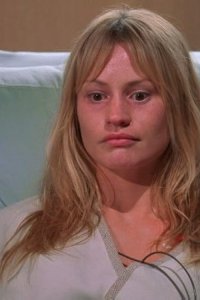 House M.D. – S02E13 – Skin Deep