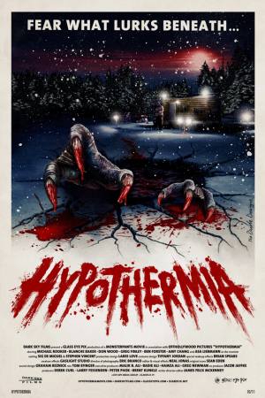 Hypothermia