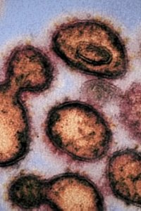 Coronavirus, Explained – S01E01 – This Pandemic